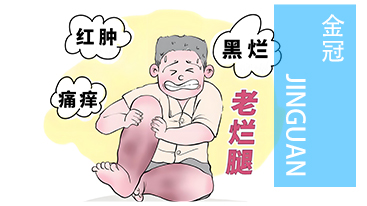 老烂腿≠不治之症：读懂静脉溃疡的来龙去脉
